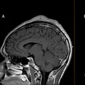 Când au văzut radiografia asta, medicilor nu le-a venit să creadă. Ce a păţit un bărbat după ce s-a învârtit în cap