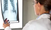 Medicamentul care promite sa trateze cancerul pulmonar