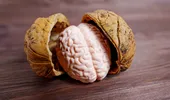 Prof. Vlad Ciurea dezvăluie alimentele care ajută creierul să funcționeze mai bine. „Beți apă. Creierul este 78% apă”