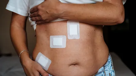 Operația laparoscopică: 9 avantaje majore față de operațiile clasice