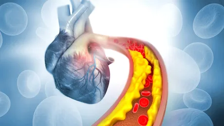 Gustarea care reduce riscul de hipertensiune. Trebuie să consumi peste 50g zilnic să fii ferit