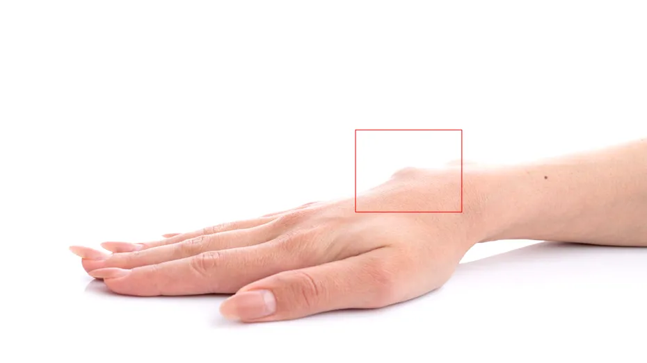 Ce este chistul sinovial și când devine o problemă?