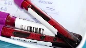 Ce analize de sânge pot arăta daca diabetul a afectat deja rinichii