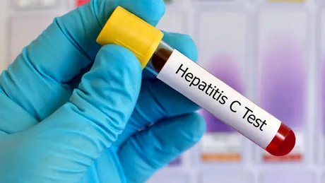 Infecţia cu virus hepatic C, teste rapide pentru români. Află unde!