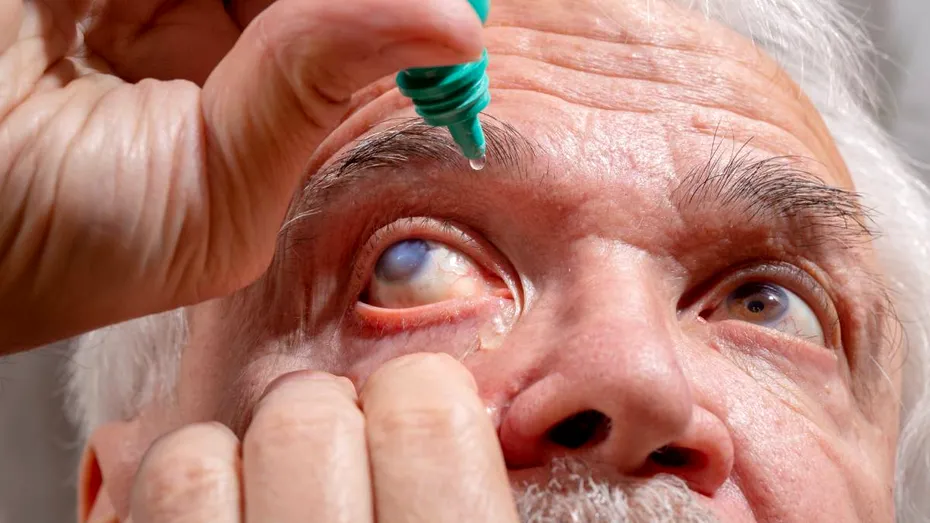 Cataracta, tratată cu laser femtosecunde: ce trebuie să știi despre intervenție