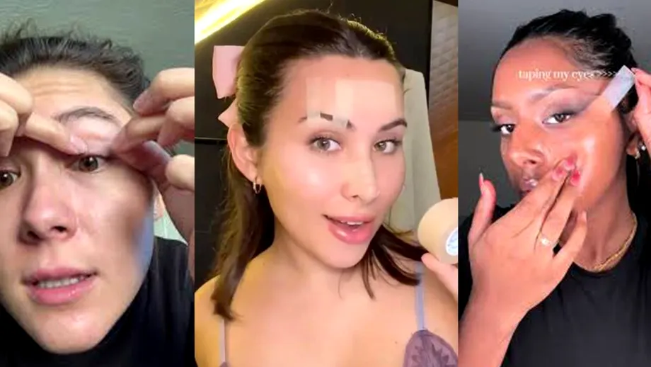 Un trend periculos de pe TikTok, drum sigur către intervenții chirurgicale la bătrânețe. Ce fac tinerii pentru a obține un efect de lifting