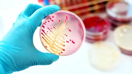 Cercetătorii au descoperit un nou antibiotic. Medicamentul care poate distruge o bacterie mortală