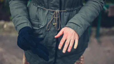 5 semne pe care ți le dă corpul când ai sensibilitate la frig. Atenție la culoarea degetelor!