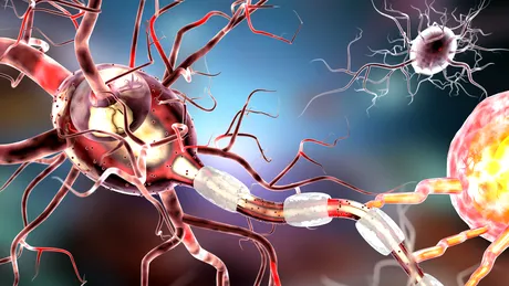 Epilepsia: simptome, tratament