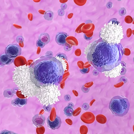 Inflamațiile, mutațiile genetice și leucemia. Studiul Oxford care oferă noi perspective în tratamentul cancerului