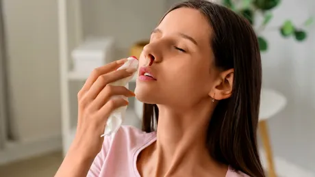 Sângerările nazale: Cauze comune și când trebuie să te îngrijorezi