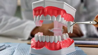 Extracție sau fără extracție în ortodonție? Ce aleg medicii și de ce