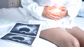 Chisturile ovariene: fals și adevărat despre această afecțiune ginecologică des întâlnită