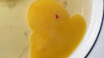 Ce înseamnă, de fapt, urmele de sânge din ou. E bine sau nu să-l mănânci?