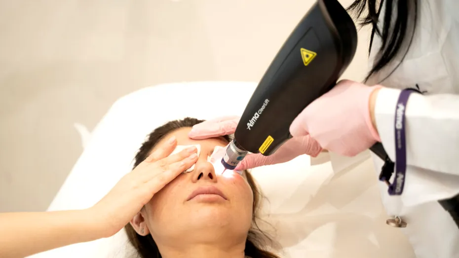 Melasma: petele pigmentare care se intensifică vara și pot fi tratate eficient toamna