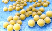 Simptome ale infecţiei cu stafilococ auriu – VIDEO by CSID