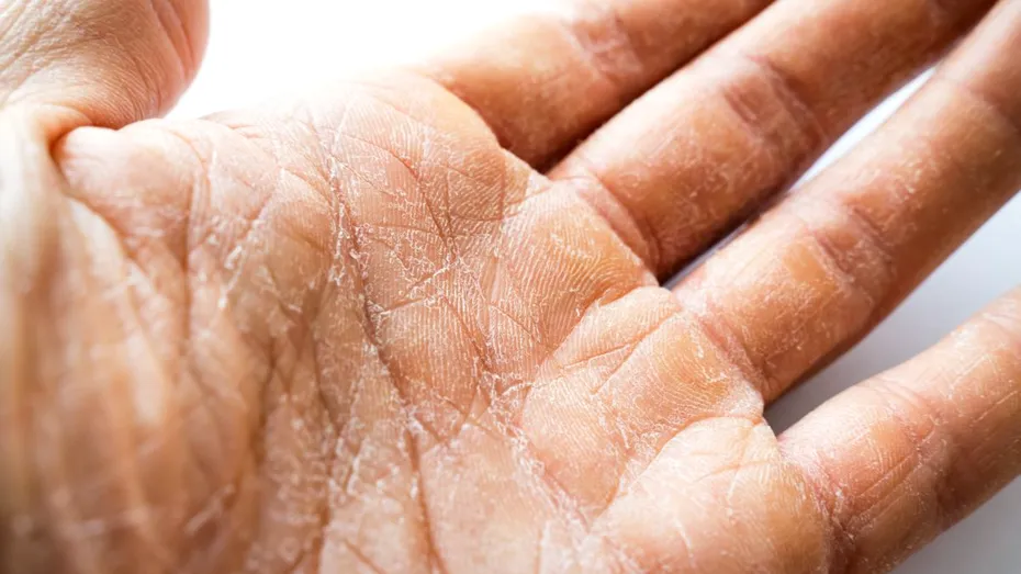 Pui prea multe rufe la spălat? Poate fi motivul pentru care ai pielea uscată. 7 greșeli de evitat pentru a preveni iritația și uscăciunea pielii