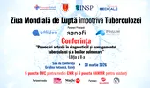 Conferință medicală dedicată Zilei Internaționale de Luptă Împotriva Tuberculozei, organizată la Galați