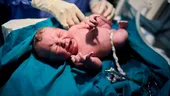 Bebelușii născuți cu această greutate riscă să facă AVC la vârsta adultă. Riscul e cu 21% mai mare