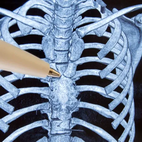 Organul misterios din corp care ar asigura longevitatea și ar putea acționa împotriva cancerului. I se mai spune și „sediul sufletului” sau „cimitirul de celule”