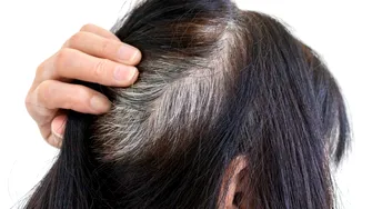 Scapi de părul alb în câteva secunde, fără vopsea. Trucul care te întinerește cu 10 ani