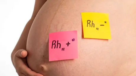 Ce înseamnă să ai RH Negativ: Tot ce trebuie să știi despre asta