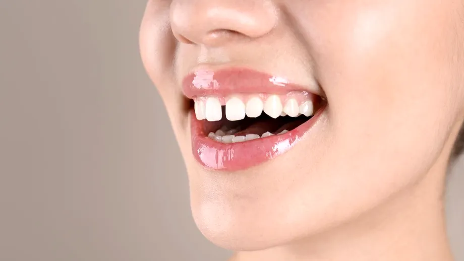 De ce apare strungăreața și cum poate fi corectată