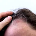 Loviturile la cap și cucuiele. Când sunt inofensive și în ce situații trebuie să mergi de urgență la medic?