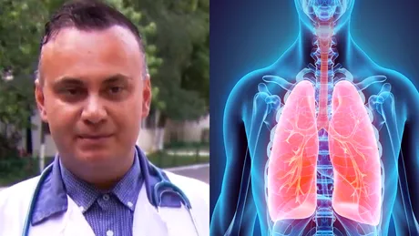 Medicul Adrian Marinescu, adevărul despre ”sindromul plămânului alb”, care a ajuns și în România: ”Este o bacterie atipică!”