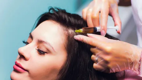 Cum funcționează mezoterapia pentru piele și scalp