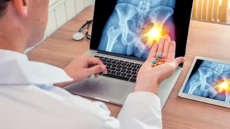 Pericolul neașteptat al corticosteroizilor folosiți în pandemie. Medic: Mulți pacienți sub 40 de ani au dezvoltat necroză de cap femural, care duce la coxartroză