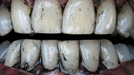 Albirea dinţilor cu cărbune – bizar, dar eficient!