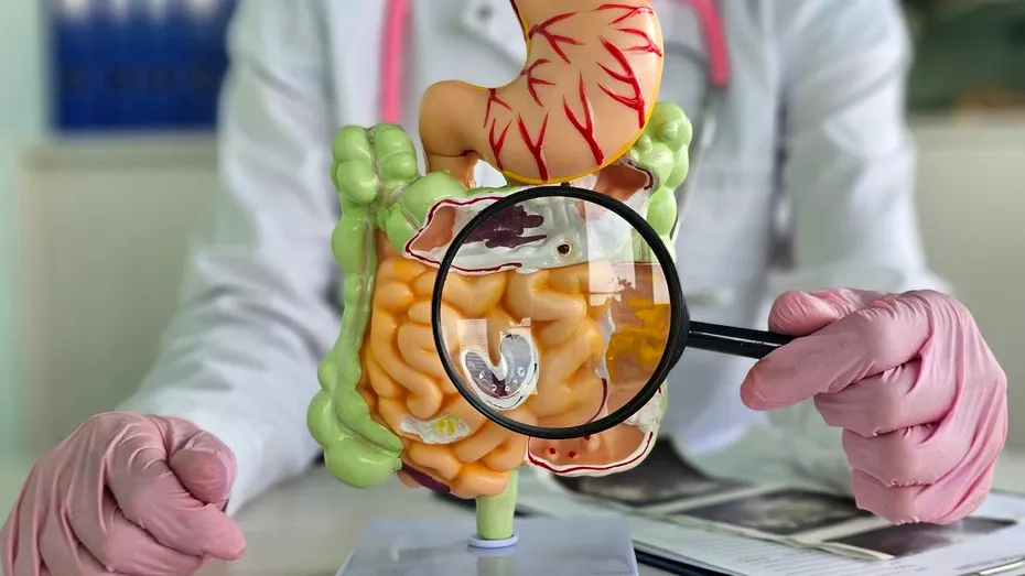 Ce să mănânci după o operație gastrointestinală. Dieta recomandată după rezecția de colon