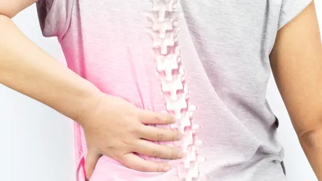 Cifoza: cauze, simptome, tratament