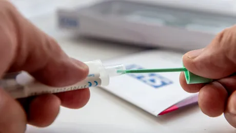 Ai observat sânge în scaun? Testele care nu trebuie amânate