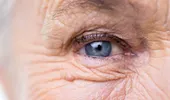 Glaucomul nu doare, dar duce la orbire! Vezi care sunt simptomele şi cine prezintă un risc crescut