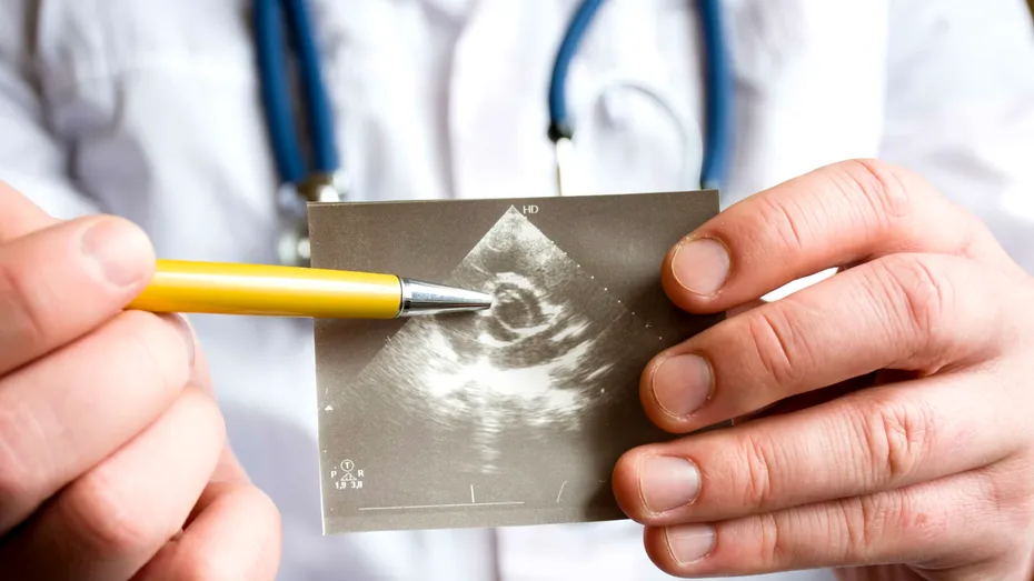 Palpitații, respirație dificilă și dureri în piept? Iată ce afecțiune gravă pot ascunde