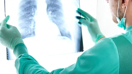 Fonduri de 5,3 milioane de euro pentru ţinerea sub control a tuberculozei