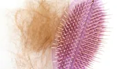 Căderea părului după COVID: care sunt cauzele, cât durează, ce soluții există