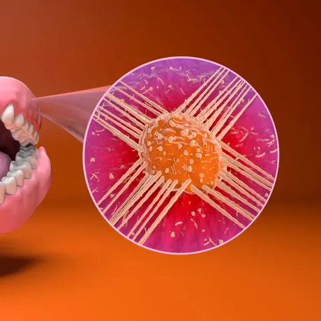 Dieta pentru prevenirea cancerului oral. Cum să te protejezi prin alimentație