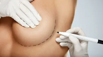 Implanturile mamare pot afecta alăptarea: adevăr sau minciună?