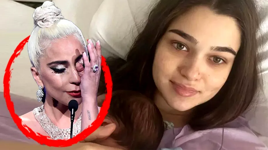 Boala groaznică de care suferă Theo Rose. Lady Gaga a avut aceeași problemă ca vedeta Pro TV