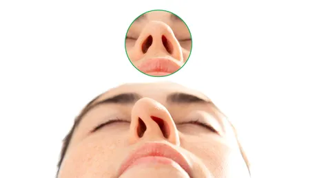 Rinoseptoplastia, operația 2 în 1: corectează aspectul nasului și deviația de sept