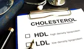 Analizele de sânge – colesterolul şi profilul lipidic
