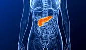 În ce constă dieta care previne cancerul de pancreas?