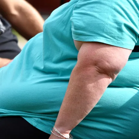 Alimente obișnuite, de zi cu zi, care te pot îngrășa pe ascuns! Pot duce la obezitate