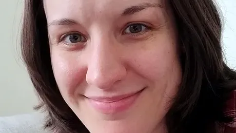 Ce a pățit femeia din imagine, după ce a mâncat morcovi în fiecare zi. Cum s-a transformat pielea ei