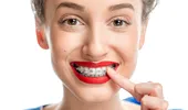 Primele zile cu aparat dentar: cum depăşim orice disconfort