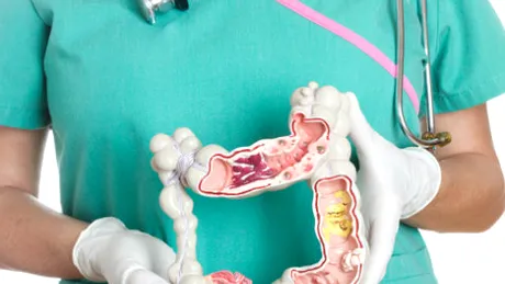 Bolile inflamatorii intestinale: tratament
