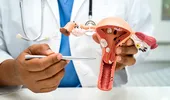 Cancerul ovarian: ce este, cât de frecvent este în România, teste care-l depistează, tratament